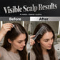 ⏳Limited-time 50% off⏰Scalp Applicator Comb Tool for Hair💧🪮